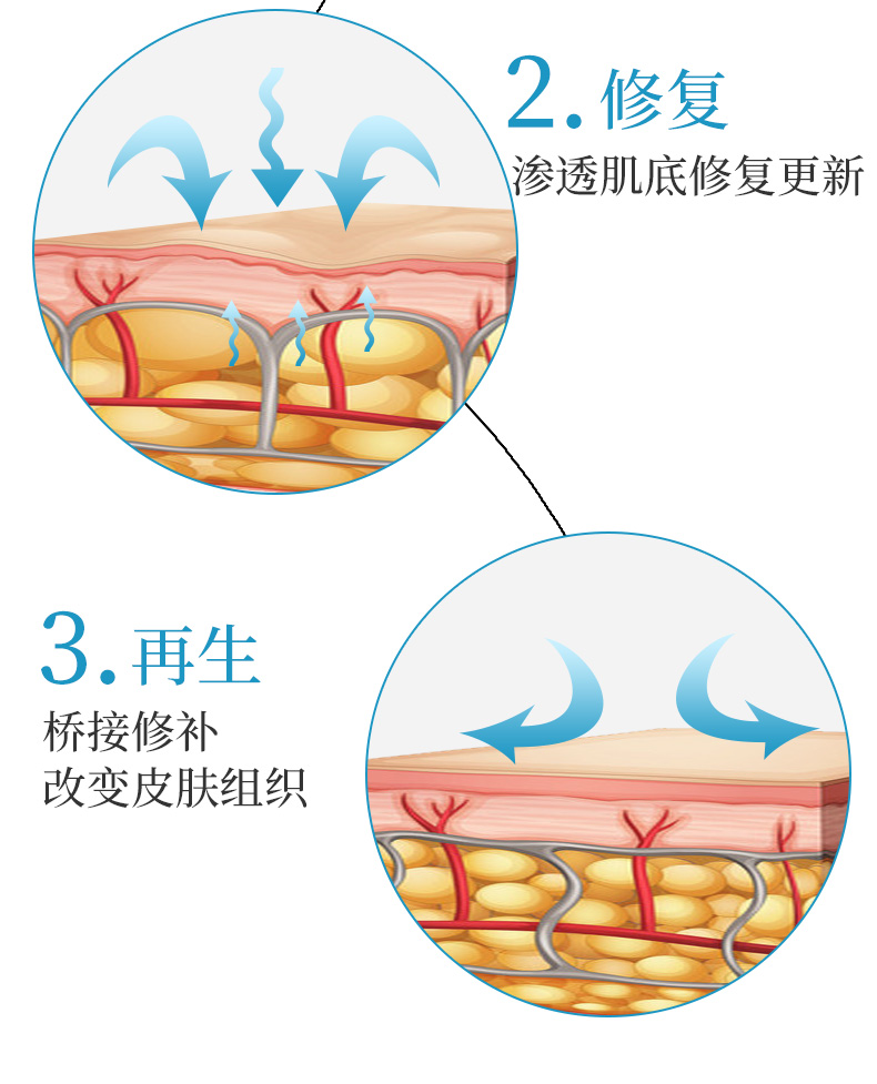 疤痕凝胶(图5)